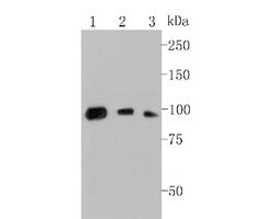 Complement C7 Antibody (15D1), Novus Biologicals 100 uL; Unconjugated:Antibodies,